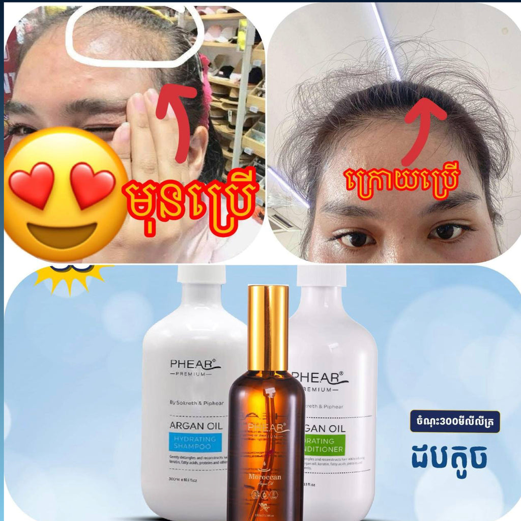 សក់មានសំណើម កំចាត់អង្គែ បណ្តុះសក់ថ្មី