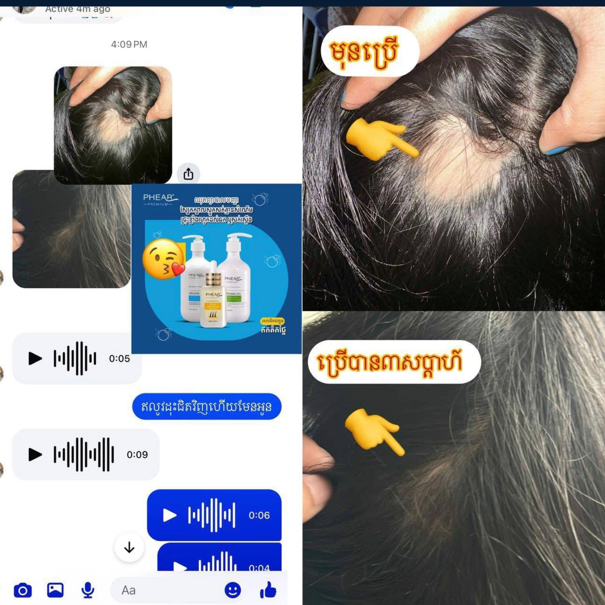 ផ្តល់សំណើមអង្គែហុយបណ្តុះសក់ថ្មី