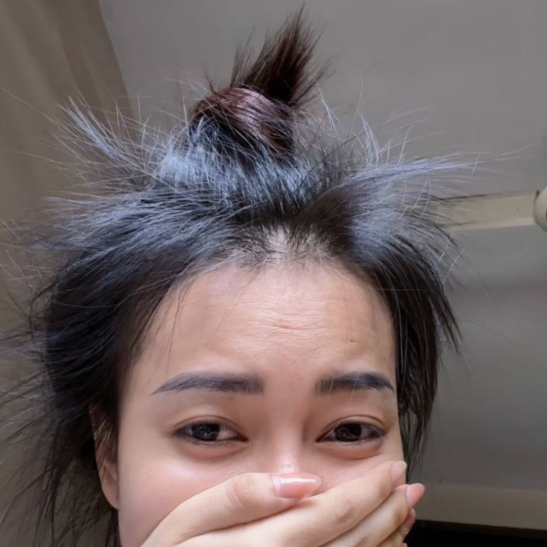 សាប៊ូកក់សក់ ទប់ស្កាត់សក់ជ្រុះ 300ml