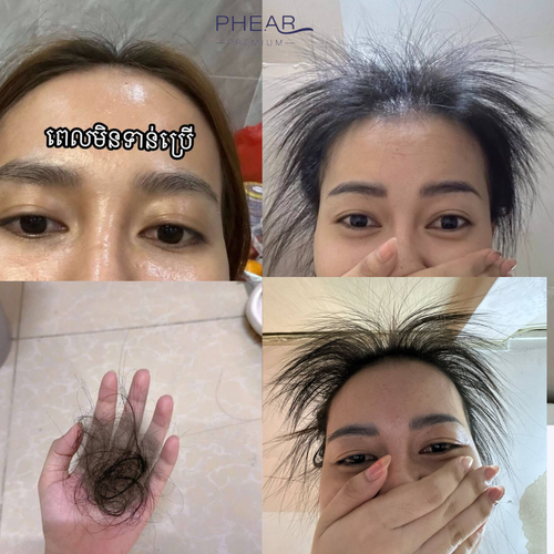 Collage of images showing hair issues with a brand name 'PHEAR' at the top.