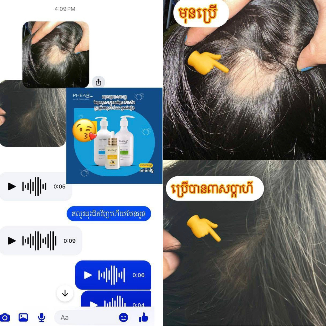 សាប៊ូកក់សក់ + សេរ៉ូមបណ្តុះសក់លឿន ឈុតធំ