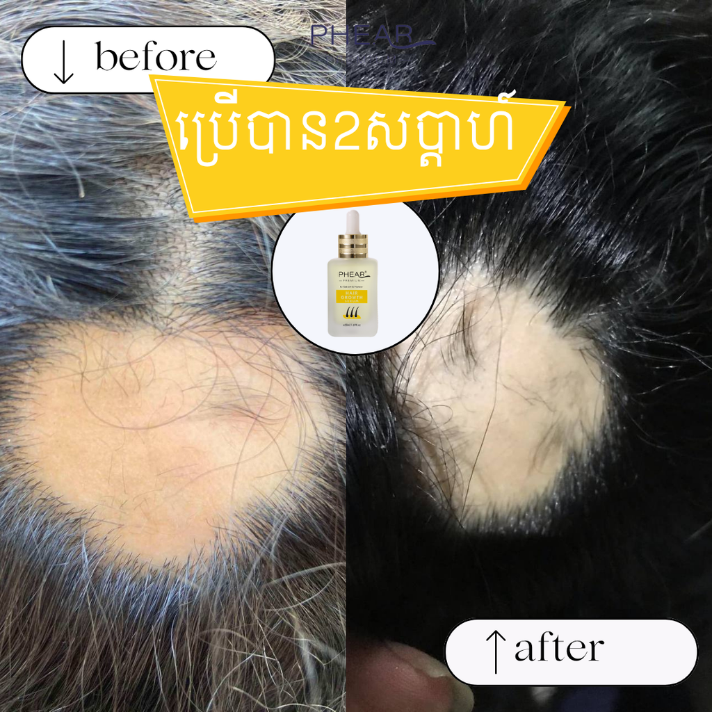 Before and after comparison of hair treatment with a bottle of serum in the center.