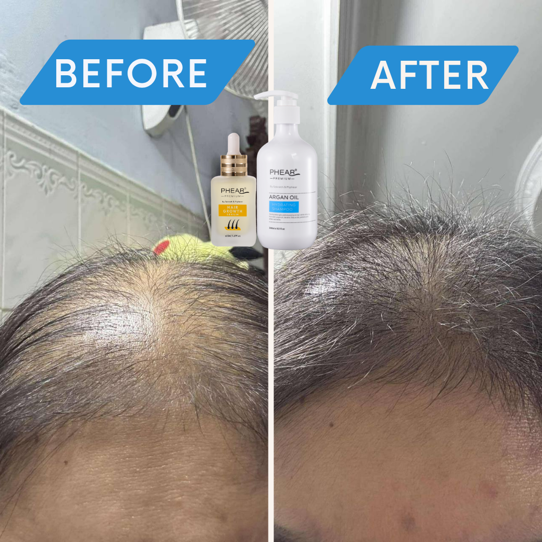Before and after 15 days comparison of hair care product application on a person's head.