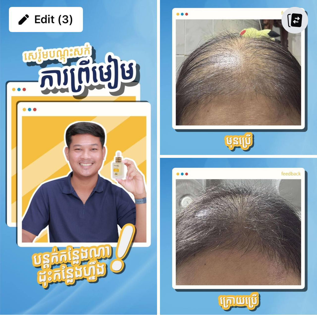 Before and after comparison of hair health with a person holding a product on a blue background.