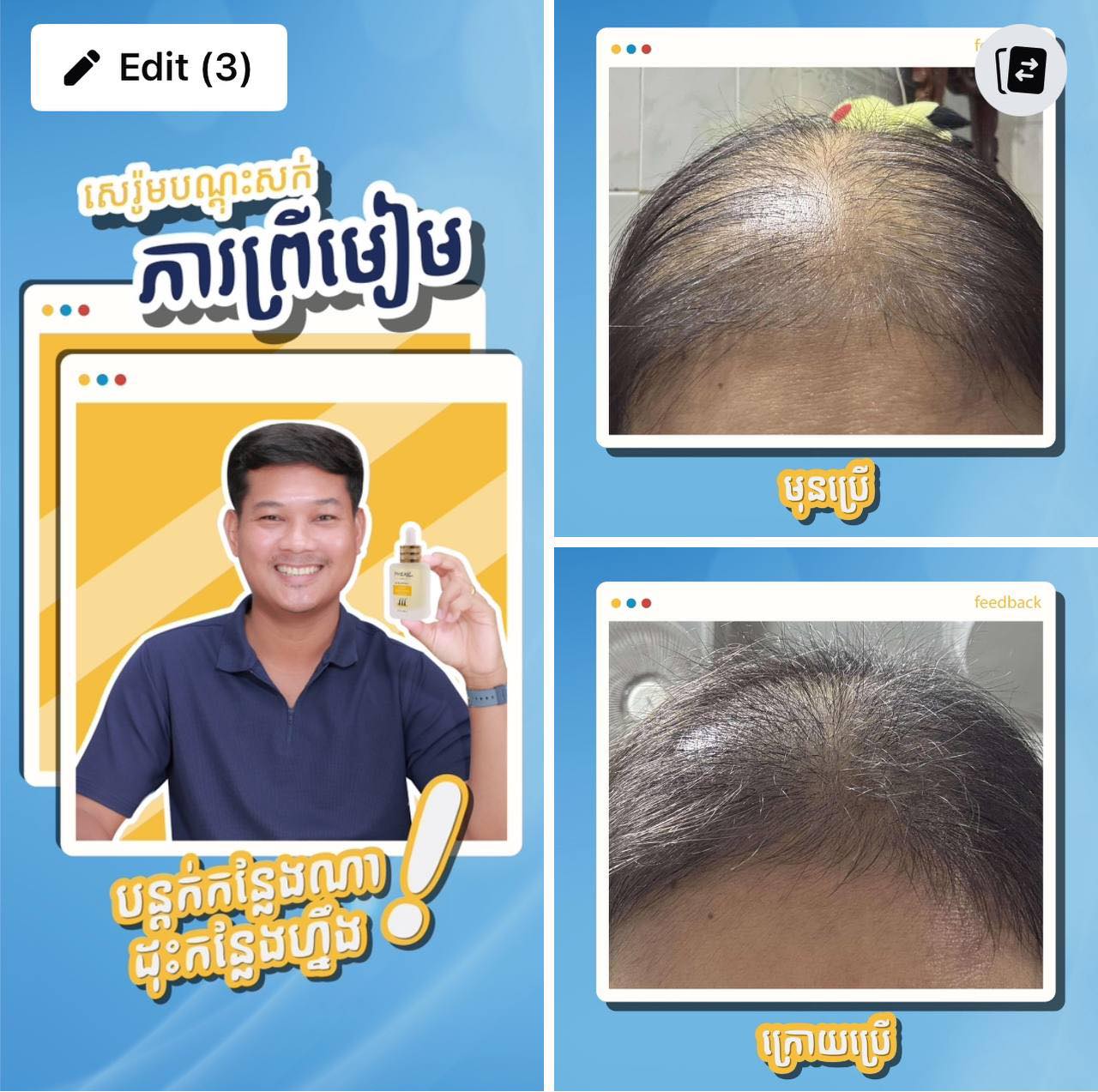 Before and after comparison of hair health with a person holding a product on a blue background.