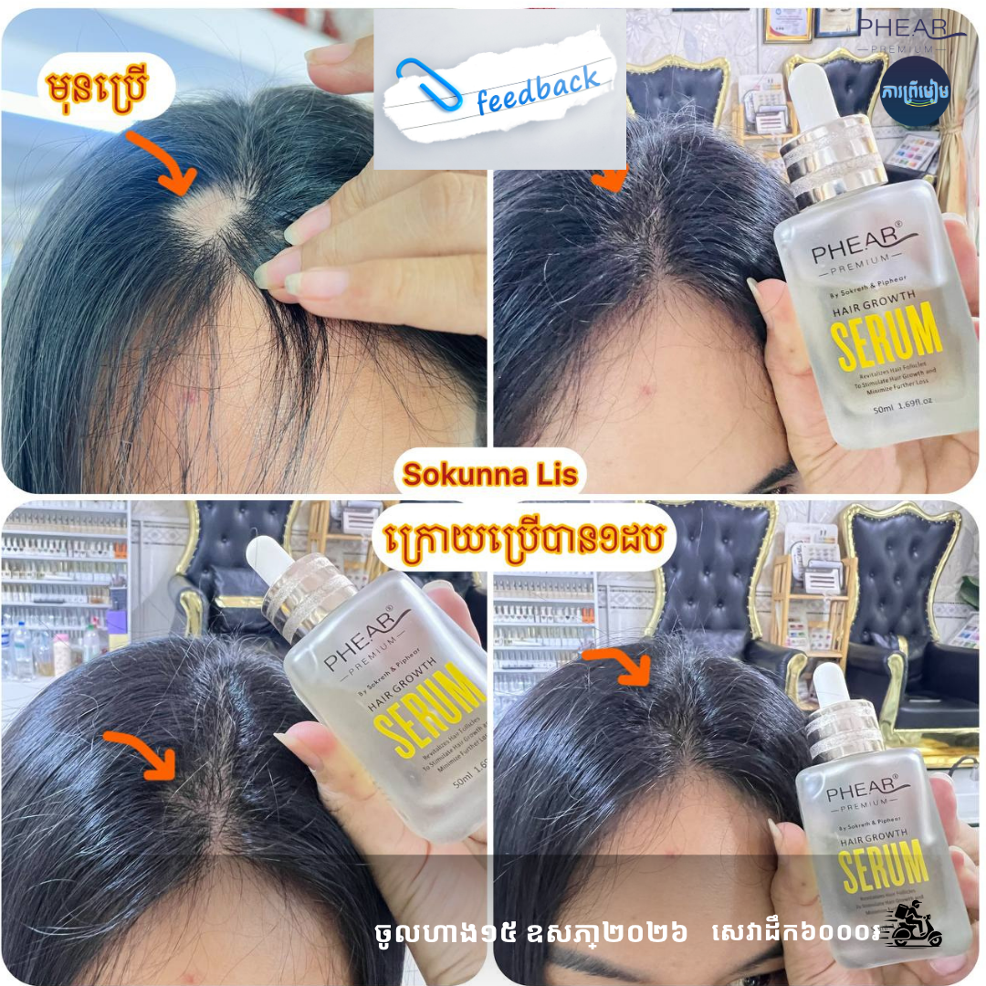 សេរ៉ូមបណ្តុះសក់50ml